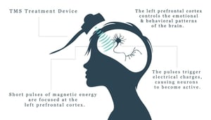 Diagram of Transcranial Magnetic Stimulation